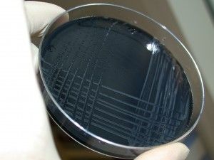 bacteria de legionella analizada en placa petri