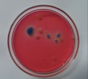 bacteria en placa petri