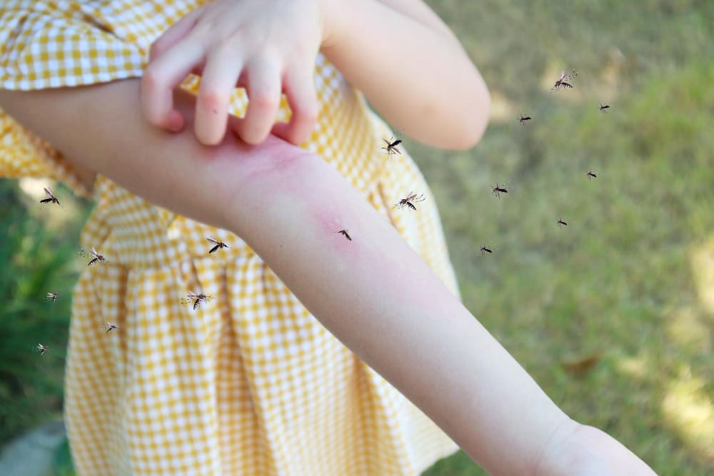 niña con picaduras de mosquito